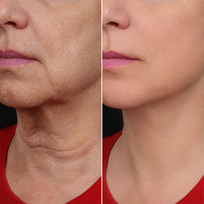 LIMETOW® Bee Venom Wrinkle Cream