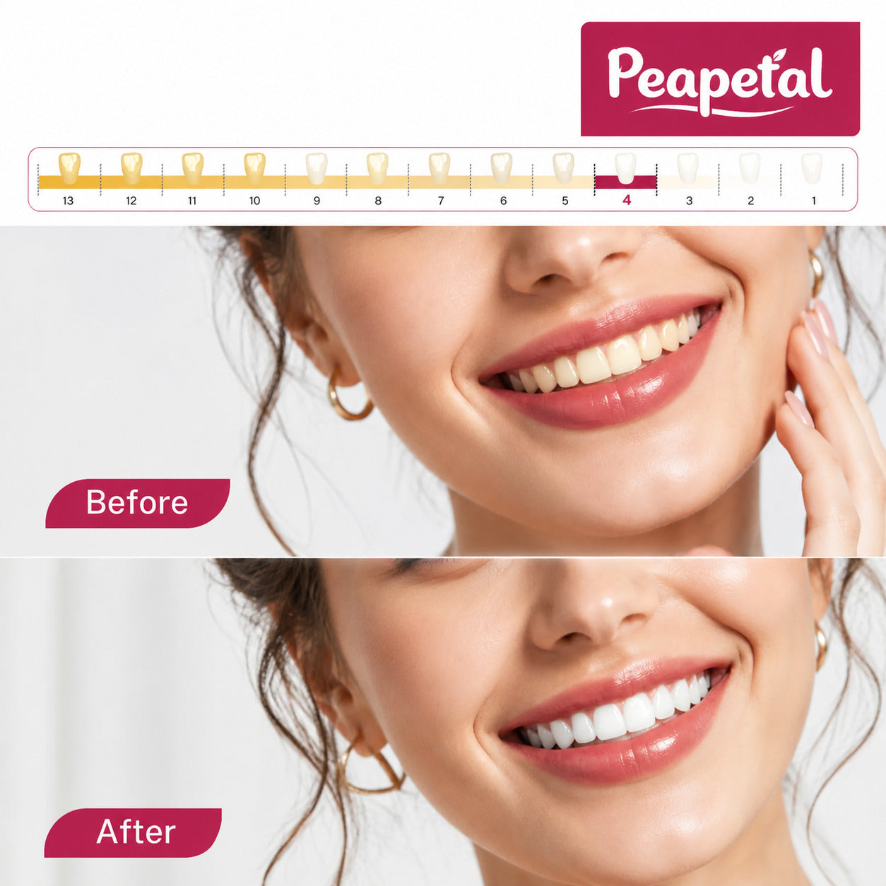 Professional Whitening System for Everyday Smile Confidence