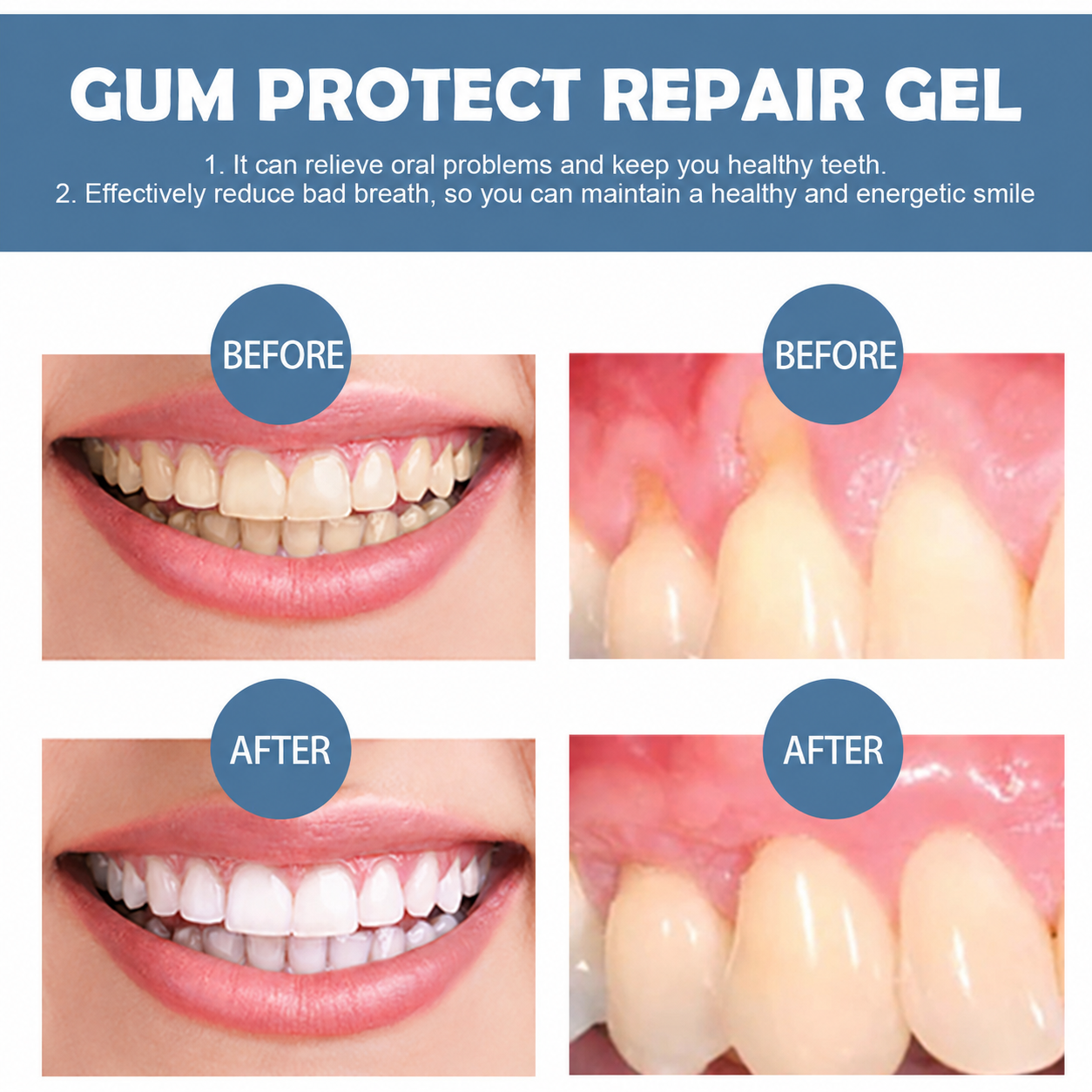 Peapetal™ Gum Repair Gel